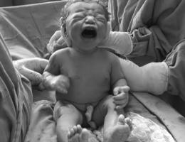 Parto na penumbra; parto humanizado; parto cesariana; parto respeitoso; parto cesárea; bem-nascida