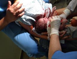Bem-nascido; Parto normal pós cesarea; parto humanizado; parto normal; Parto respeitoso; parto sob anestesia