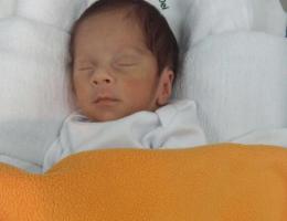 Bebê nascer empelicado,a estatística é de 1:80.000 nascimentos. Bem-nascido Lucca